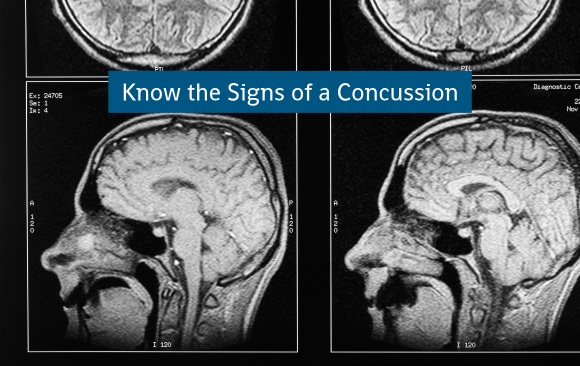 BLOG_Know The Signs of a Concussion Prevent Summer Injuries - Know The Signs Of A Concussion